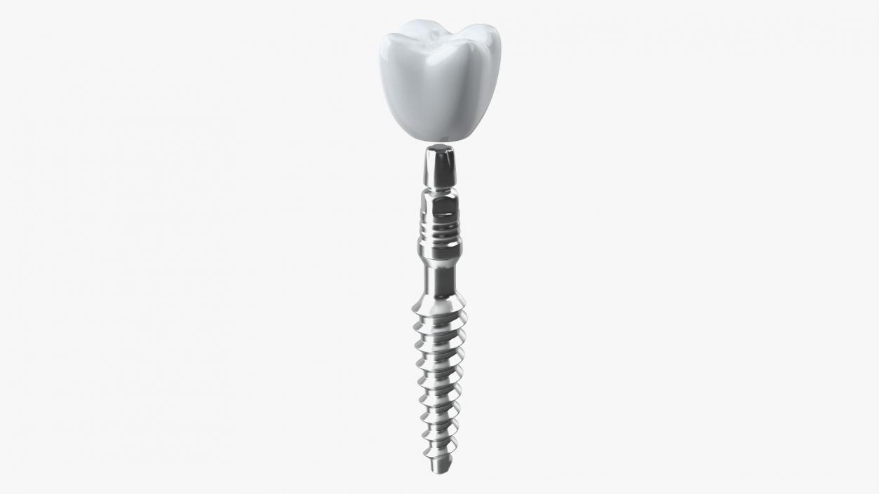 Tooth Implants Collection 3 3D