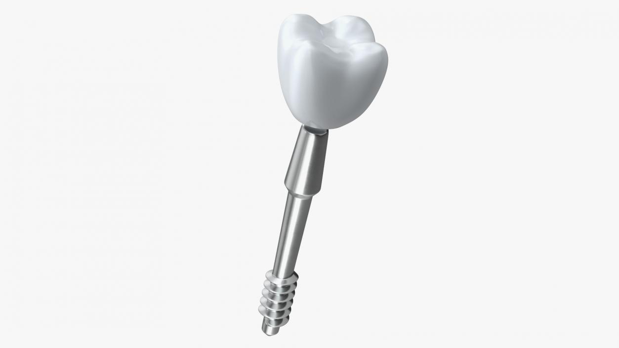 Tooth Implants Collection 3 3D