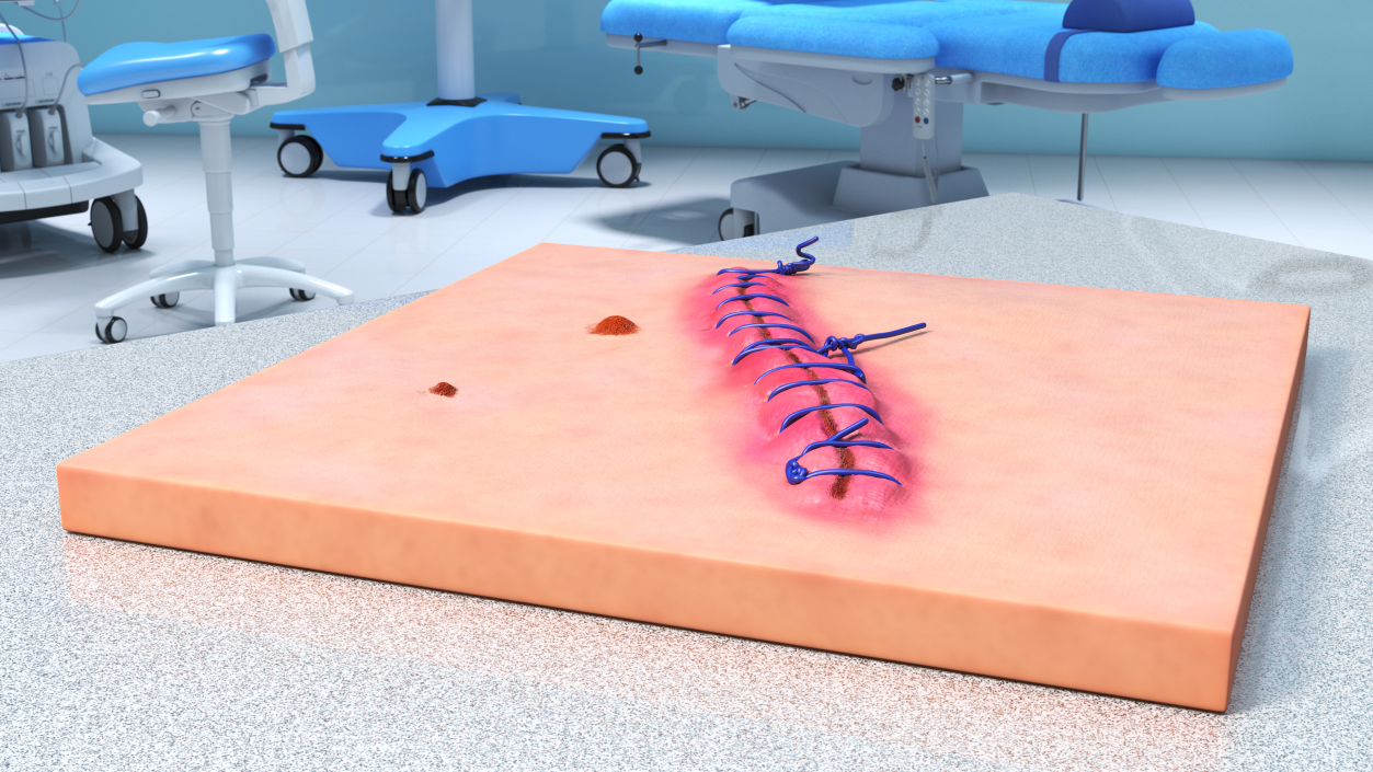 Skin with Medical Seam Open 3D