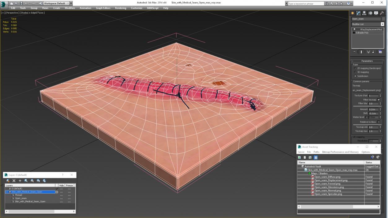Skin with Medical Seam Open 3D