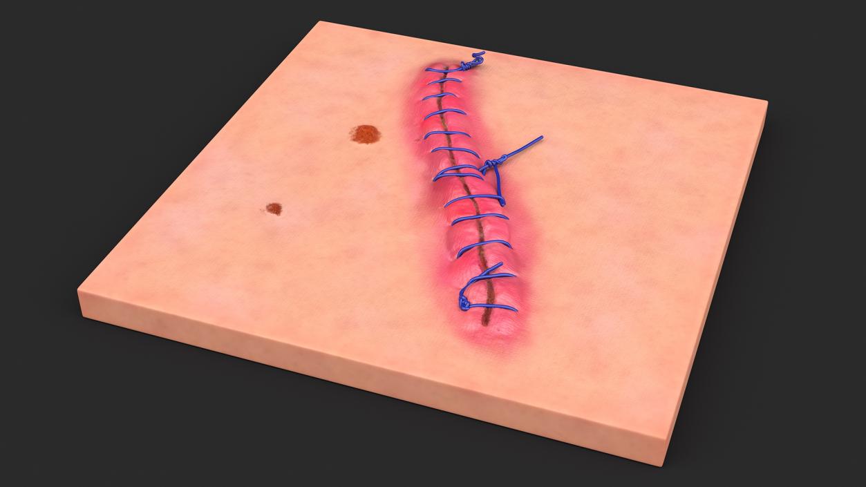 Skin with Medical Seam Open 3D