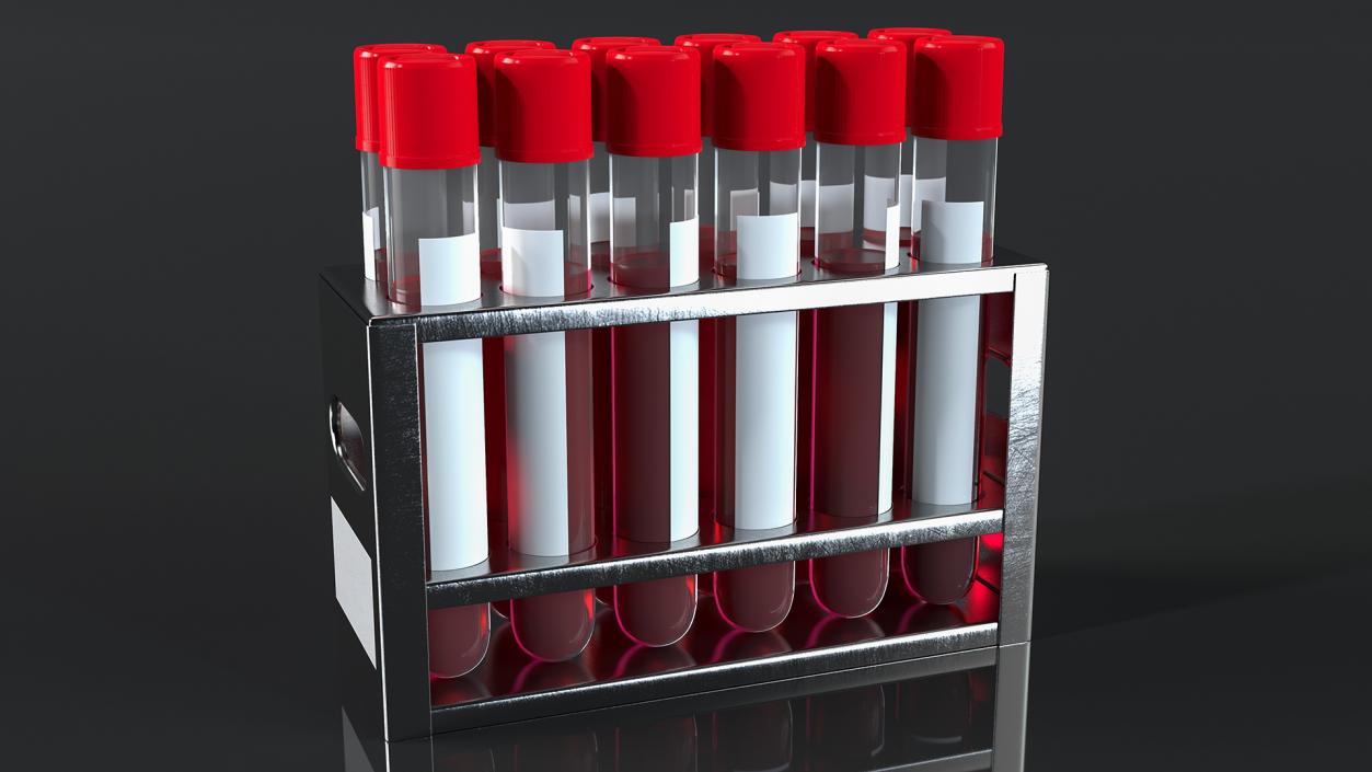 Stainless Steel Test Tube Rack with Blood Samples 3D model