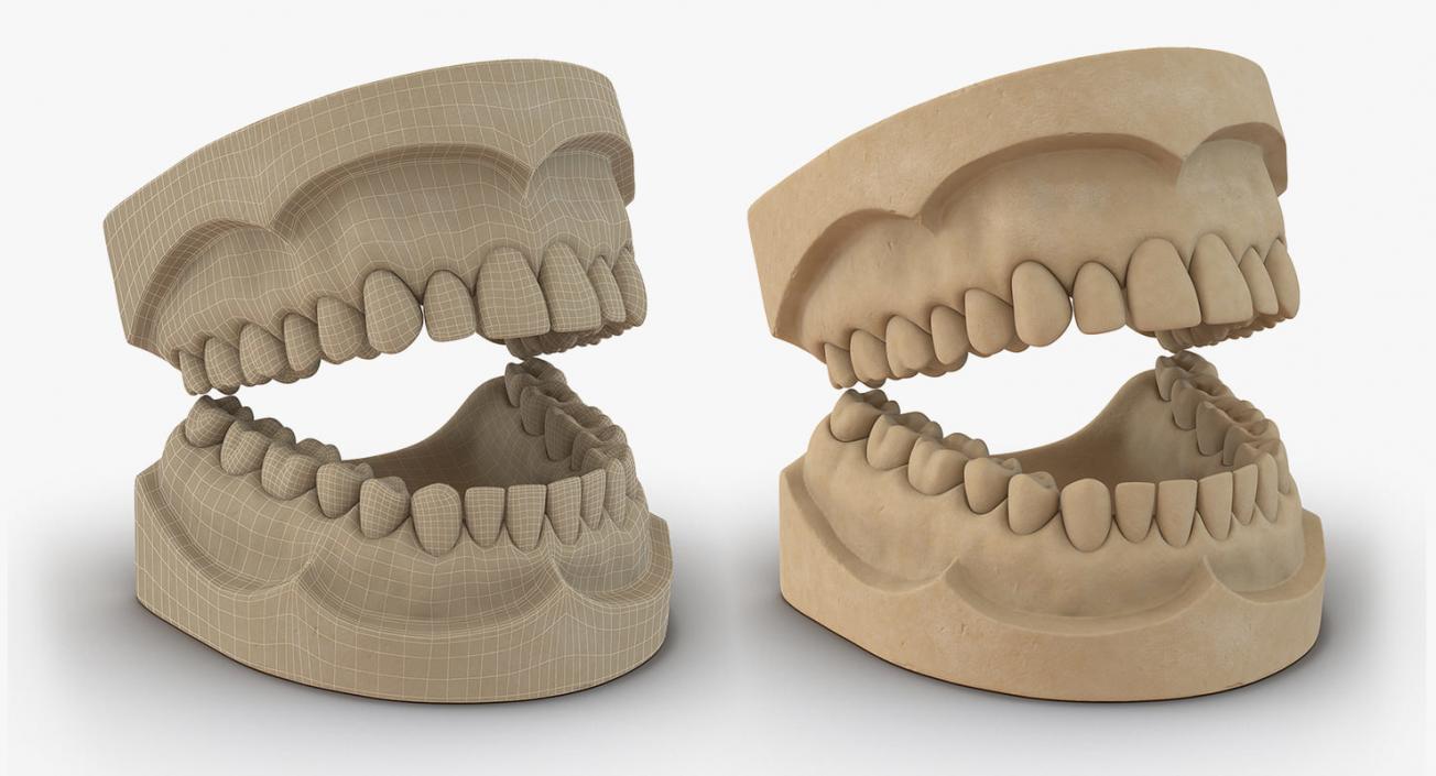 Dental Collection 5 3D model