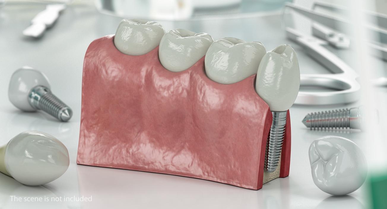 Dental Collection 5 3D model