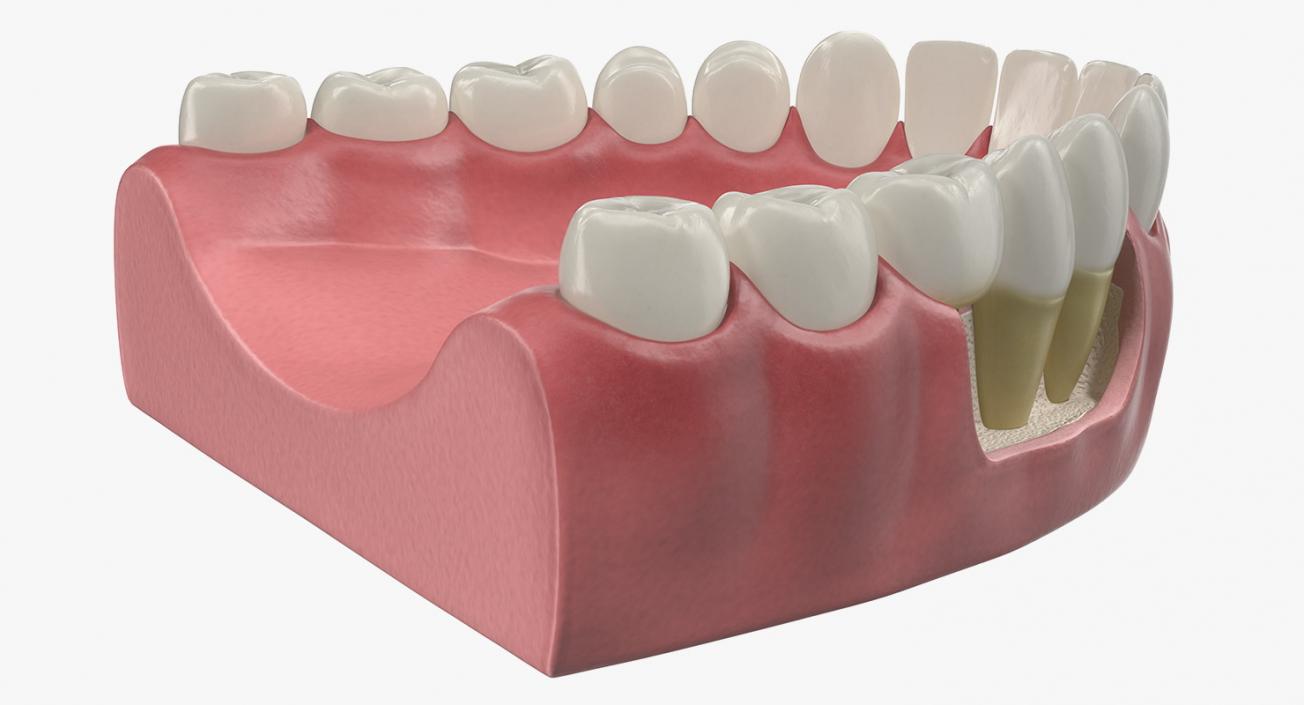 Dental Collection 5 3D model