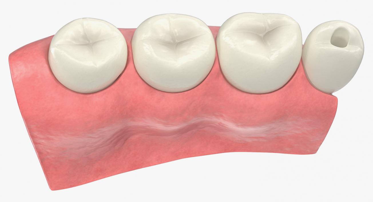 Dental Collection 5 3D model