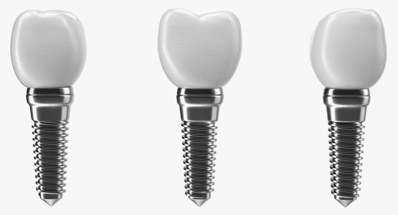 Dental Collection 5 3D model