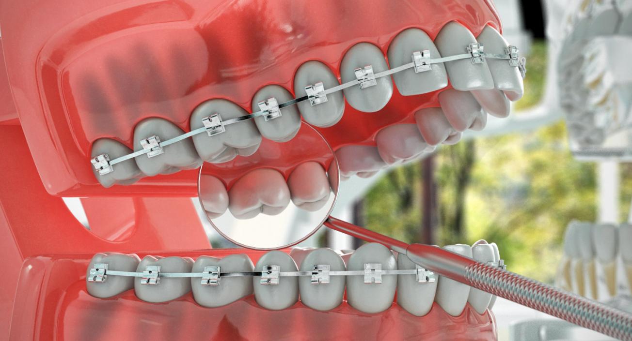 Dental Collection 5 3D model