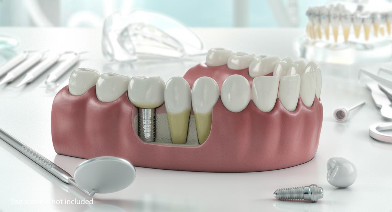 Dental Collection 5 3D model