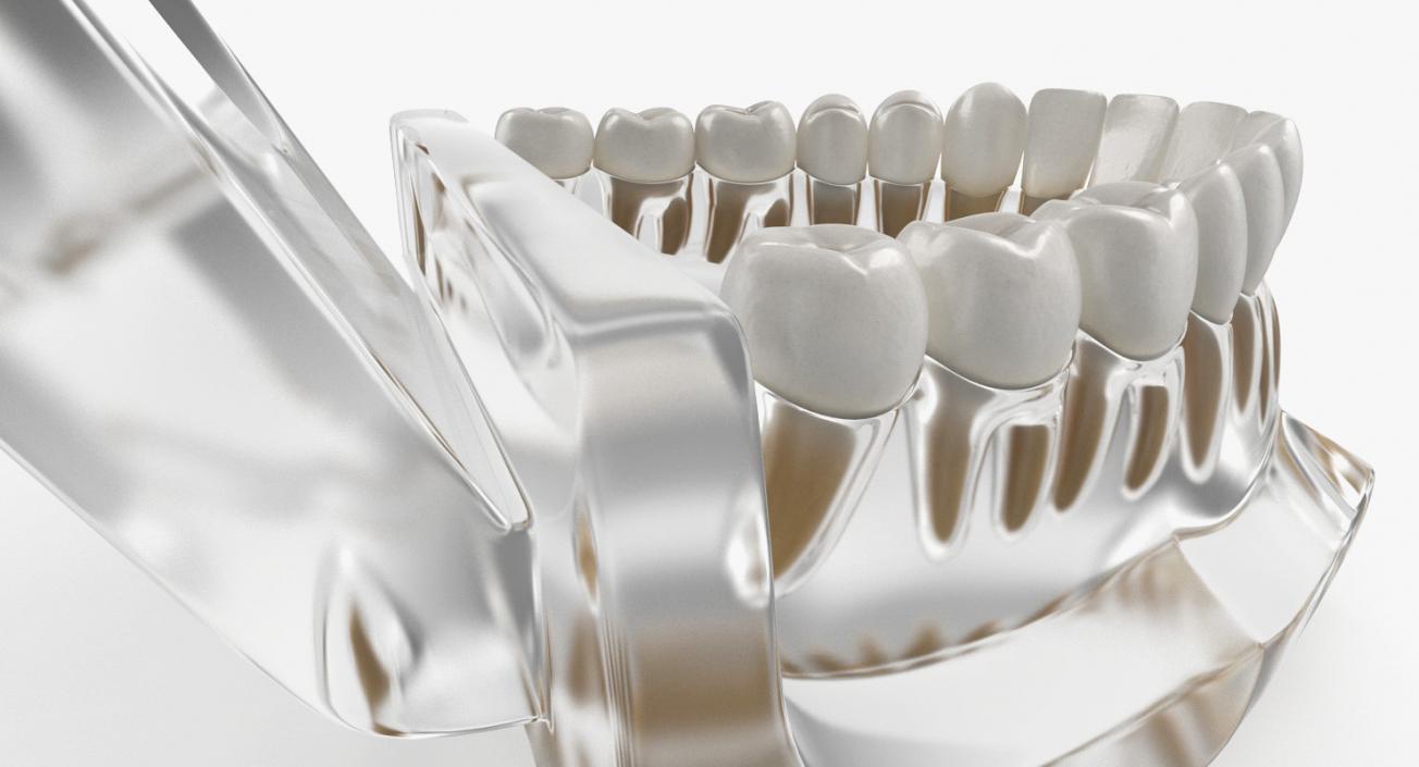 Dental Collection 5 3D model