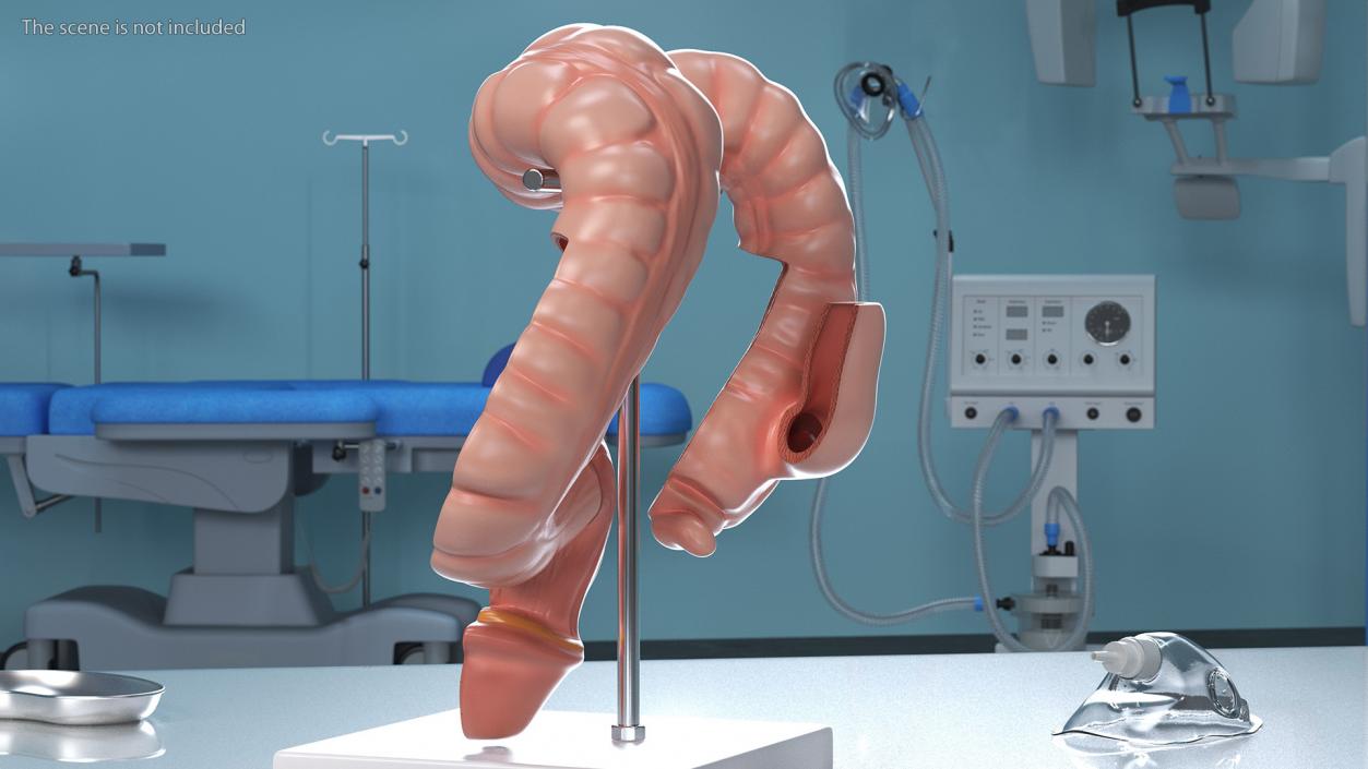 Medical Model Diseased Intestine 3D