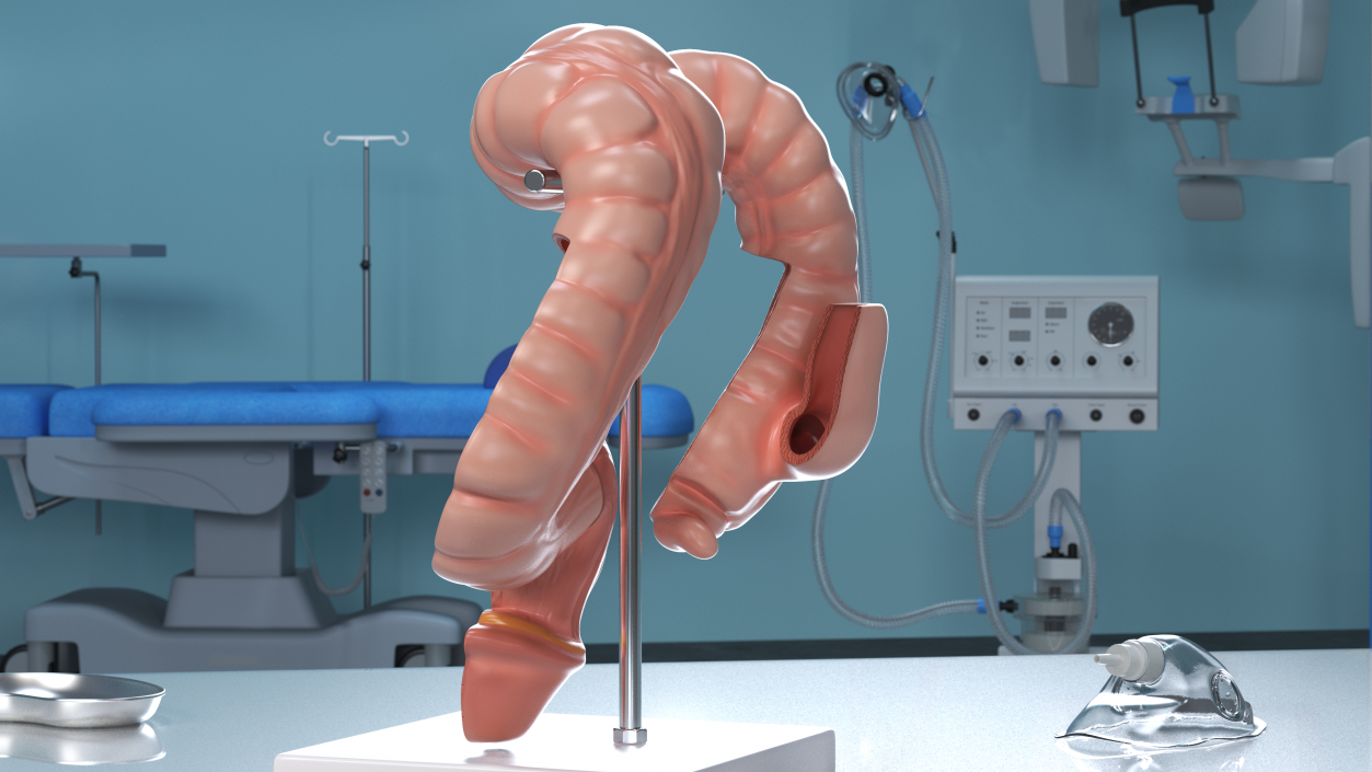 Medical Model Diseased Intestine 3D