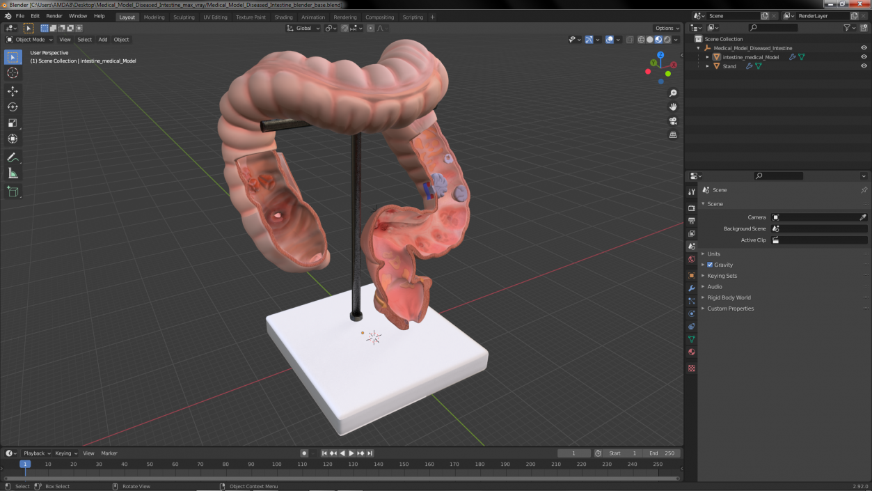 Medical Model Diseased Intestine 3D