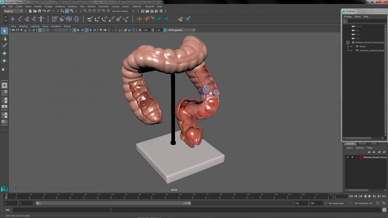 Medical Model Diseased Intestine 3D