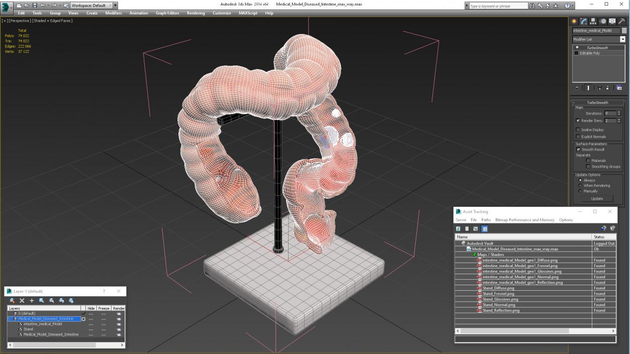 Medical Model Diseased Intestine 3D