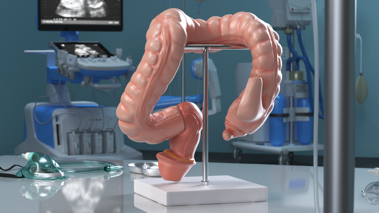 Medical Model Diseased Intestine 3D