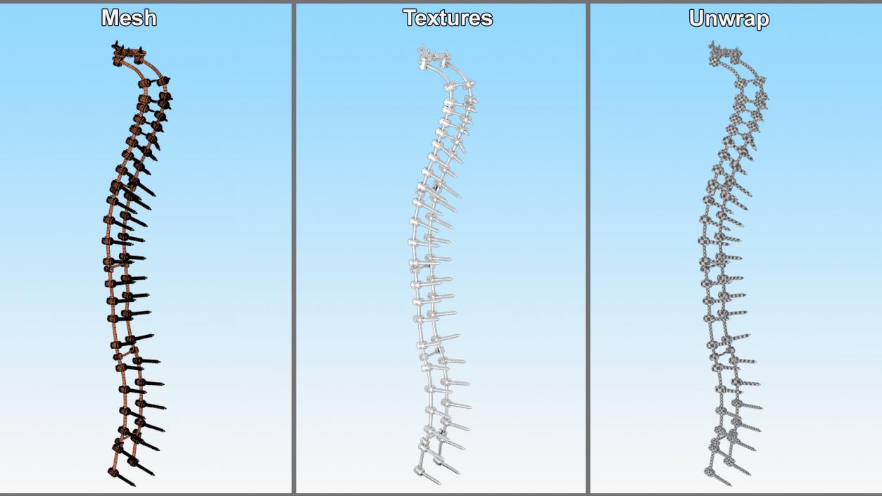 3D Spine Fixation System