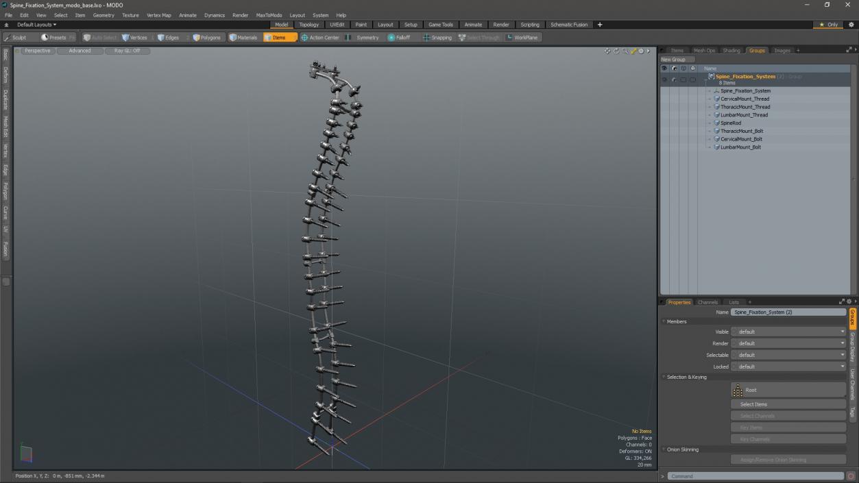 3D Spine Fixation System