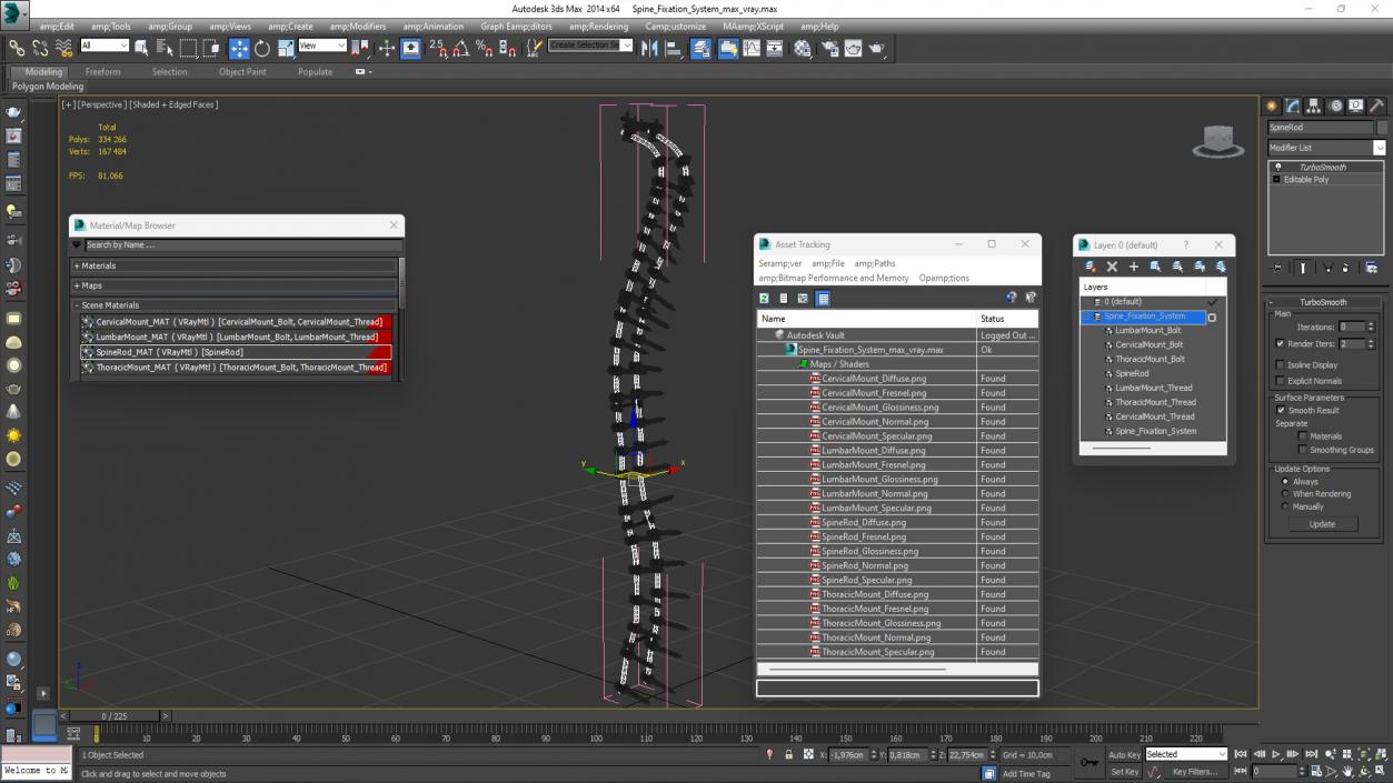 3D Spine Fixation System