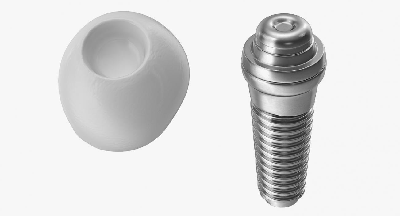 3D model Tooth Implants Collection