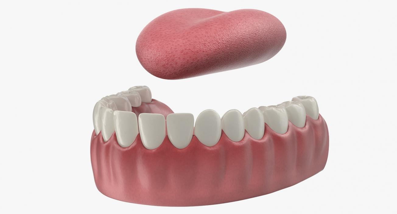 3D model Tooth Implants Collection