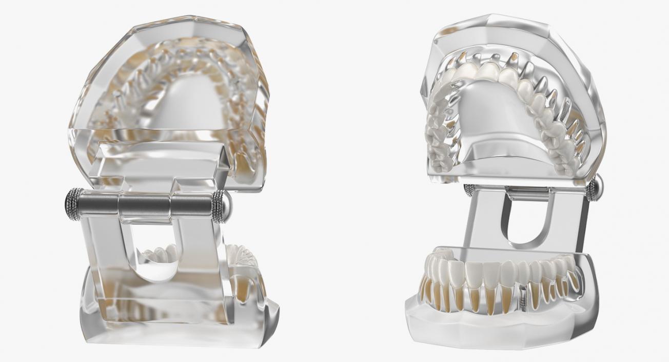 3D model Tooth Implants Collection