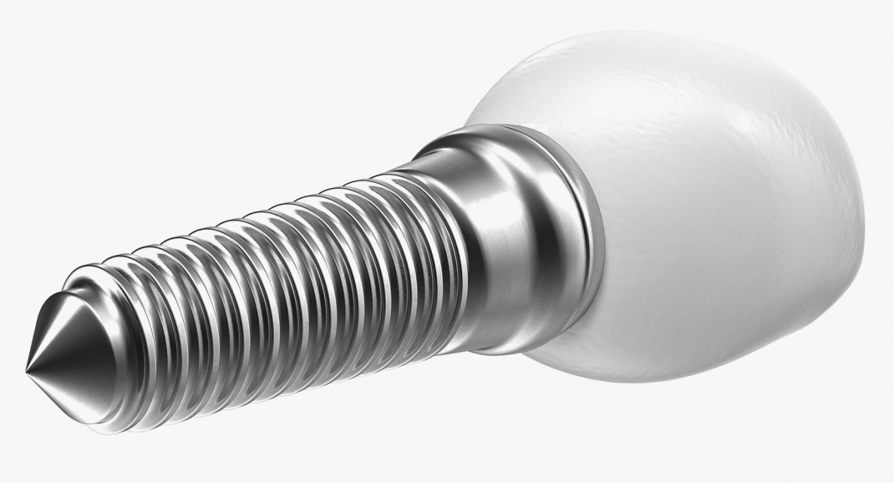 3D model Tooth Implants Collection