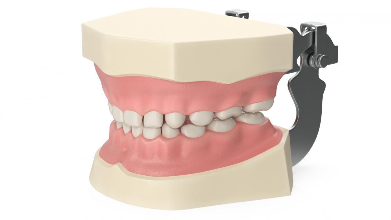 3D model Dental Anatomy Pediatric Typodont Model with Removable Teeth