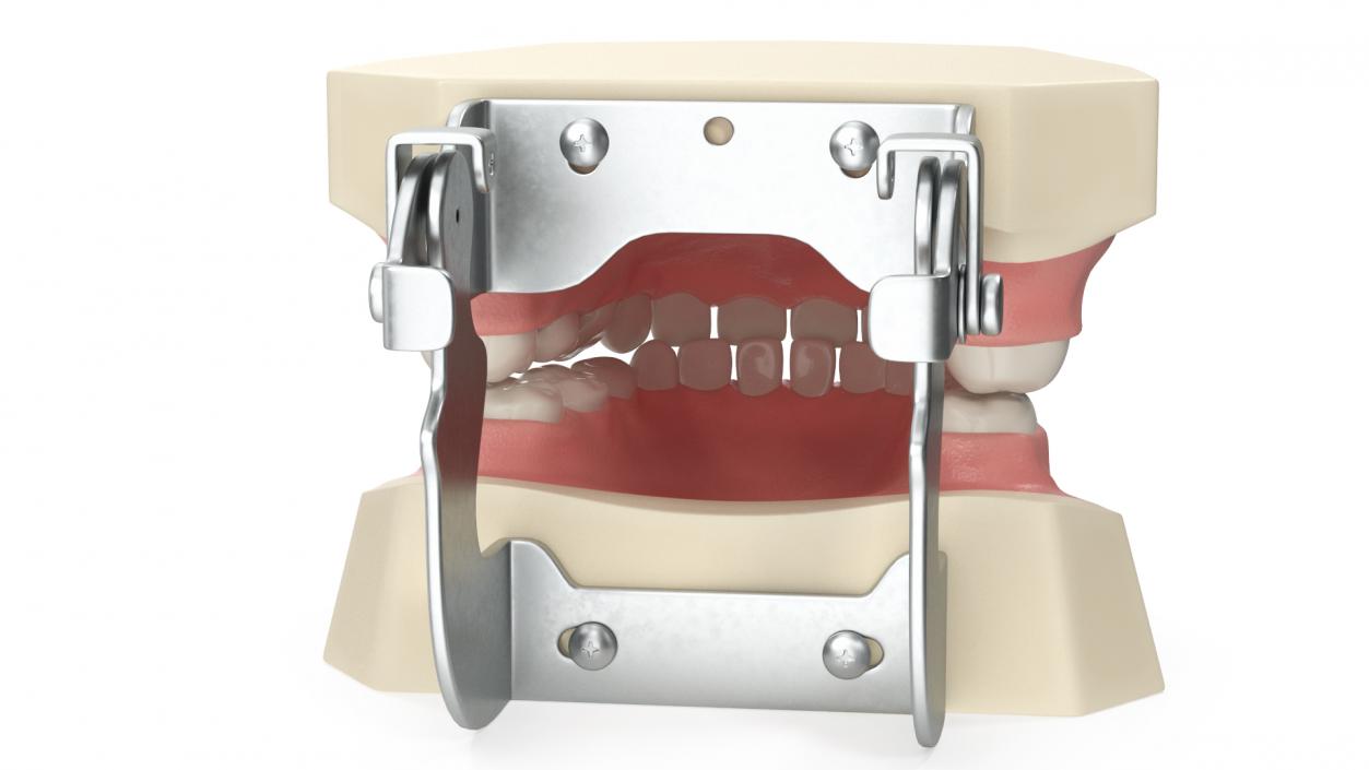 3D model Dental Anatomy Pediatric Typodont Model with Removable Teeth