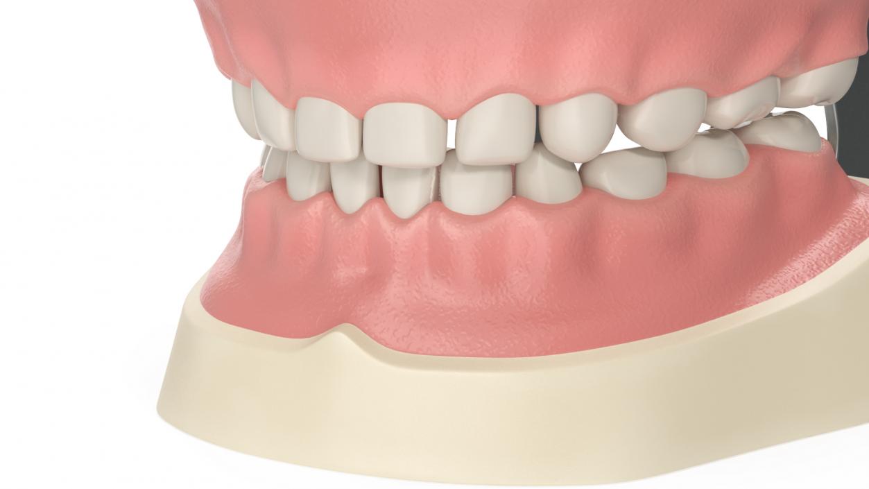 3D model Dental Anatomy Pediatric Typodont Model with Removable Teeth