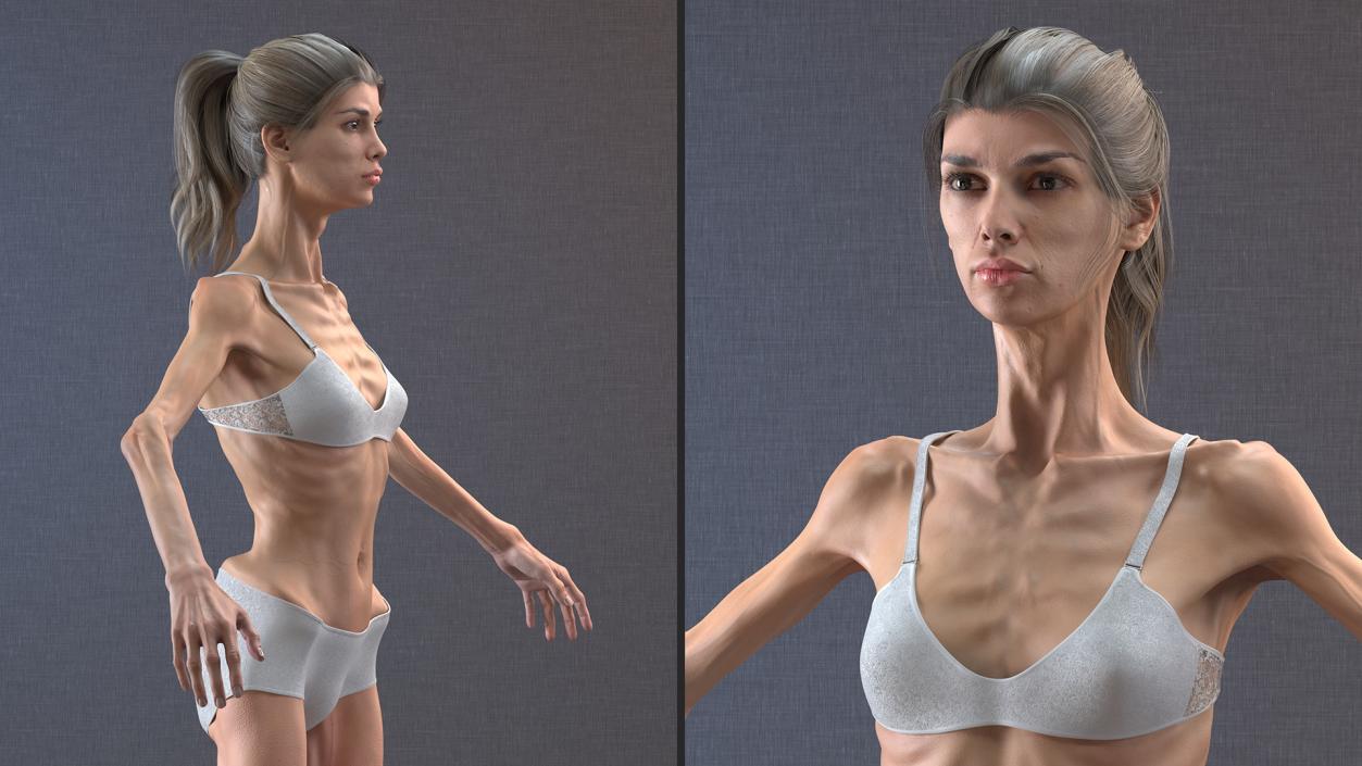 3D Anorexic Woman T-Pose