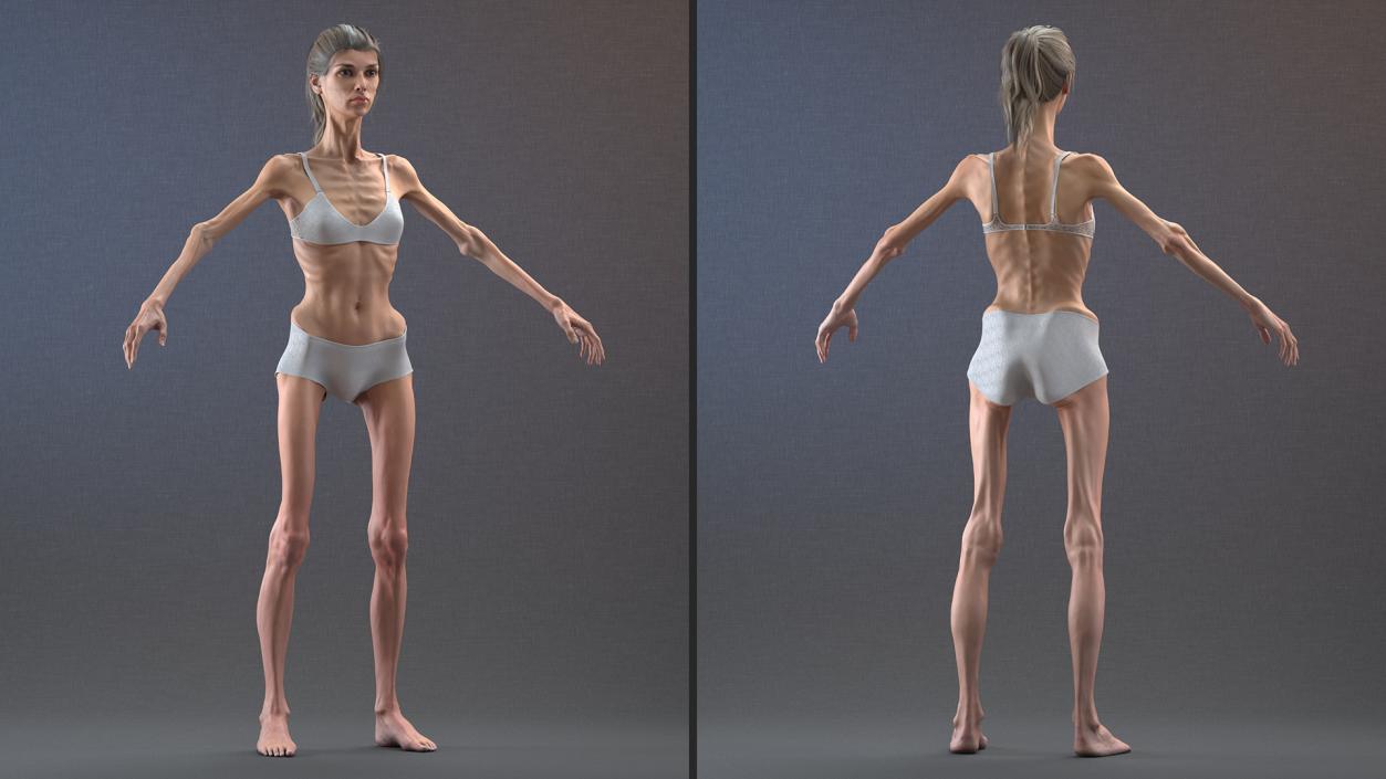 3D Anorexic Woman T-Pose