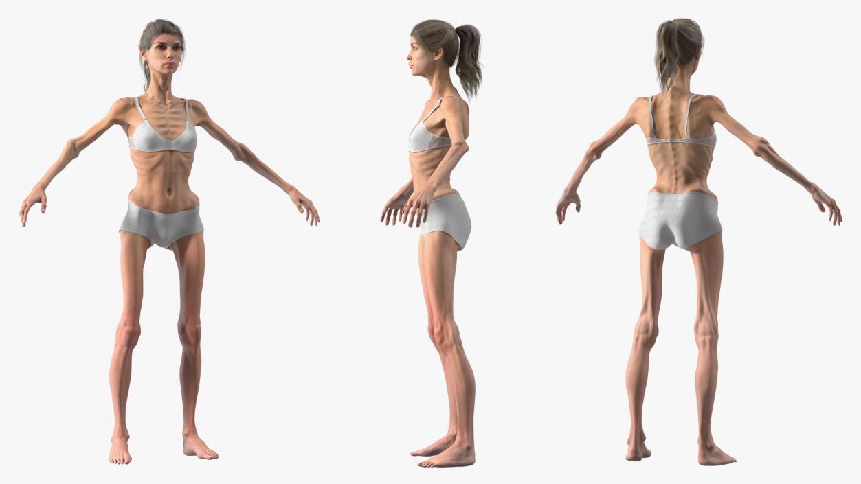 3D Anorexic Woman T-Pose