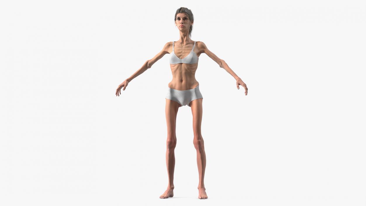 3D Anorexic Woman T-Pose