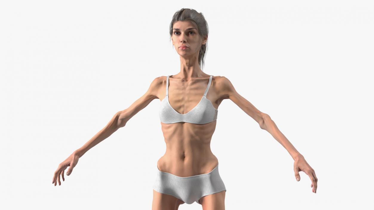 3D Anorexic Woman T-Pose