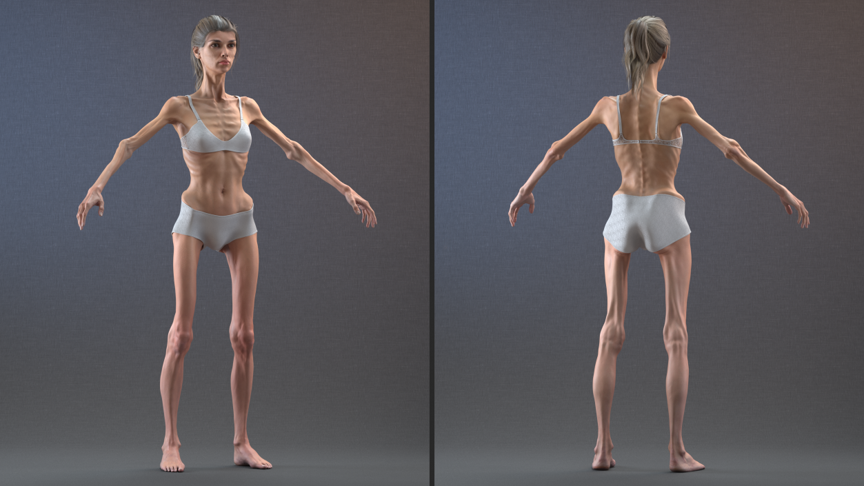 3D Anorexic Woman T-Pose