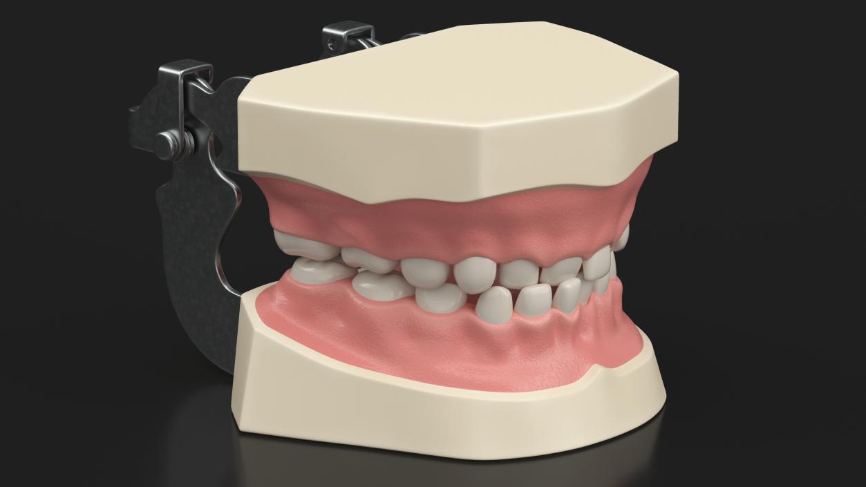 Dental Anatomy Model Simulation with Removable Crossbite Teeth 3D