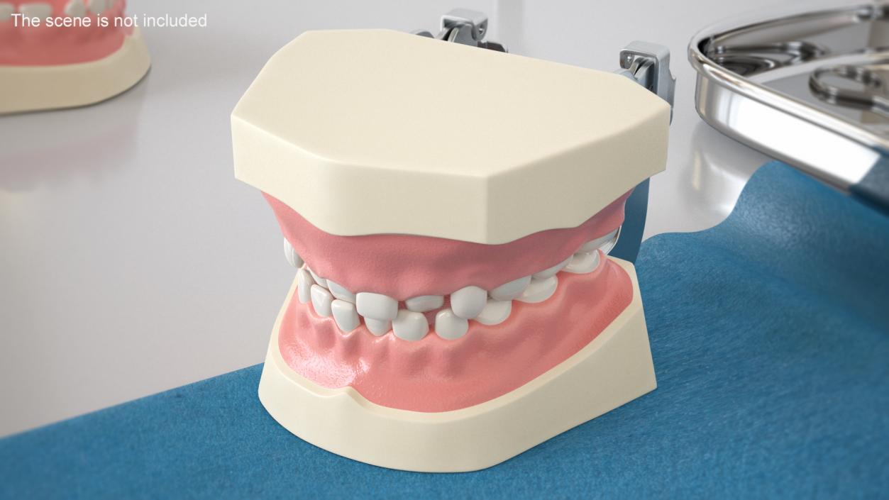 Dental Anatomy Model Simulation with Removable Crossbite Teeth 3D