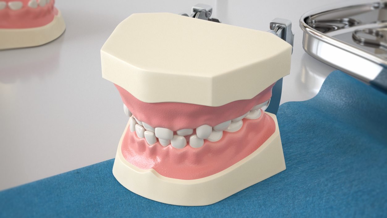 Dental Anatomy Model Simulation with Removable Crossbite Teeth 3D