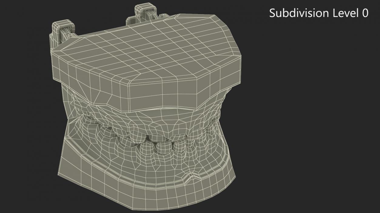 Dental Anatomy Model Simulation with Removable Crossbite Teeth 3D