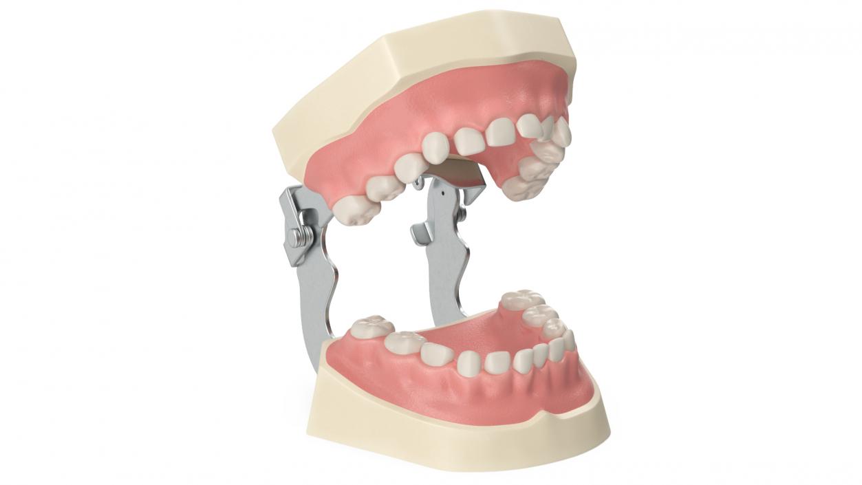 Dental Anatomy Model Simulation with Removable Crossbite Teeth 3D