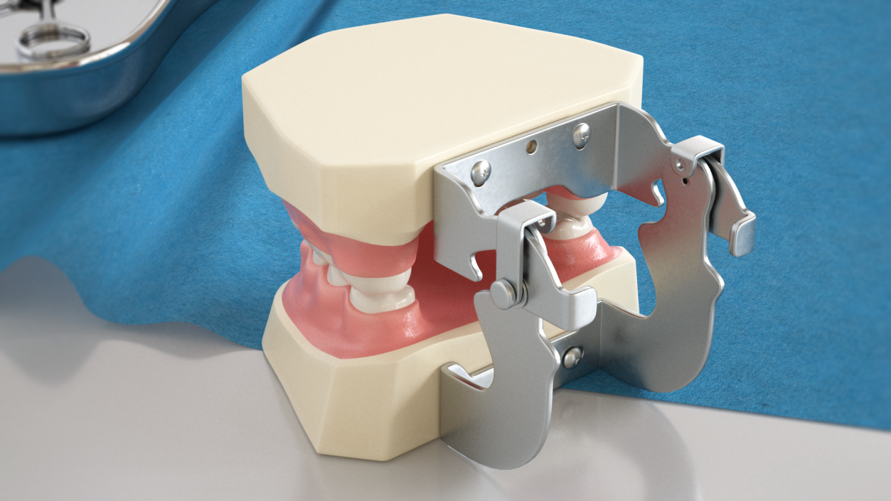 Dental Anatomy Model Simulation with Removable Crossbite Teeth 3D