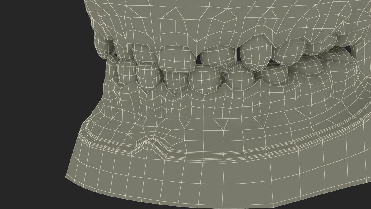 Dental Anatomy Model Simulation with Removable Crossbite Teeth 3D