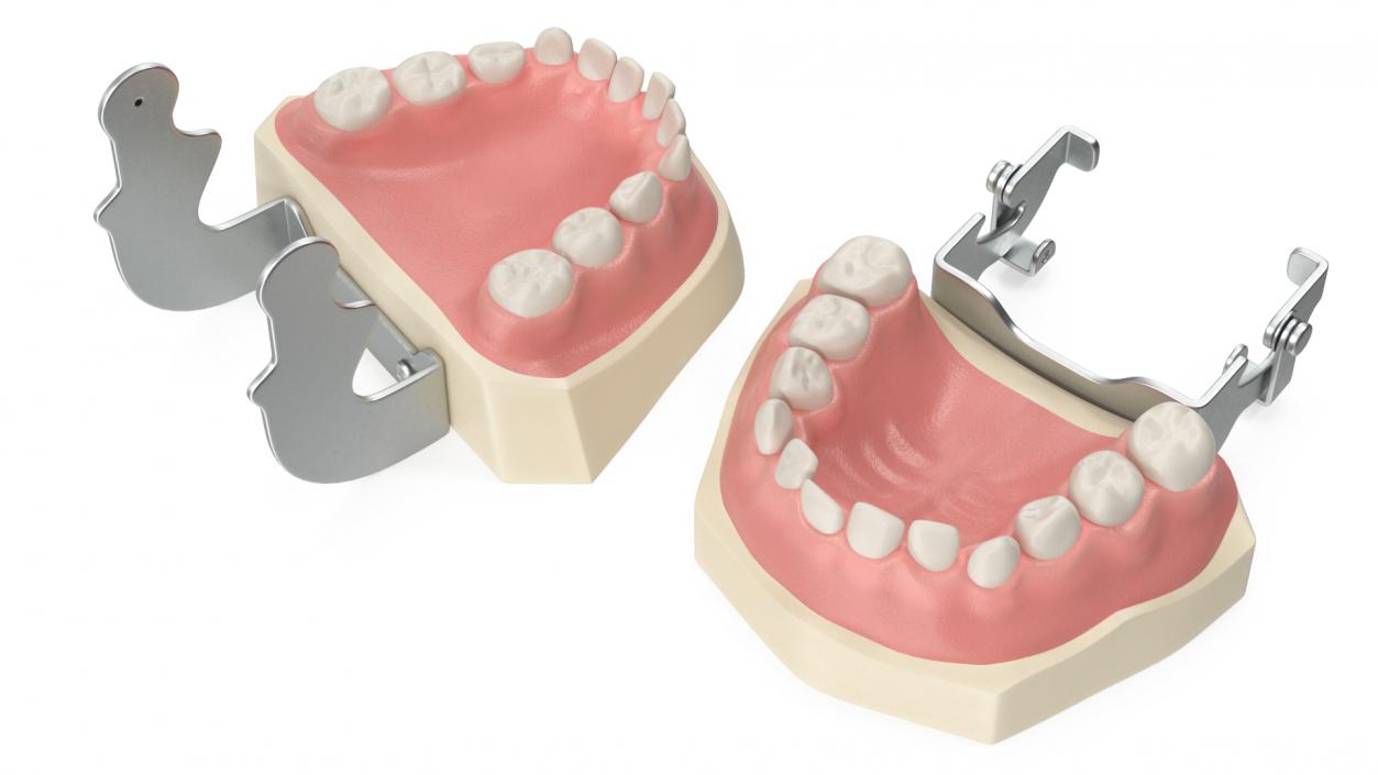 Dental Anatomy Model Simulation with Removable Crossbite Teeth 3D