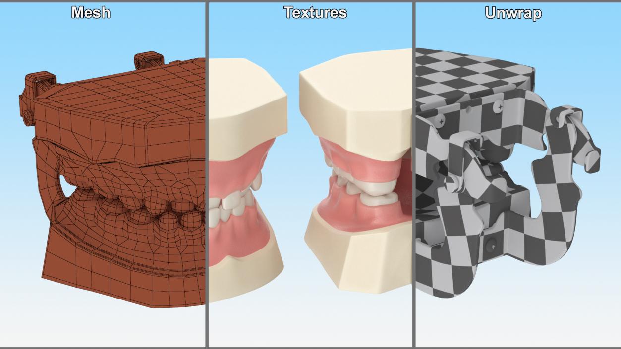 Dental Anatomy Model Simulation with Removable Crossbite Teeth 3D