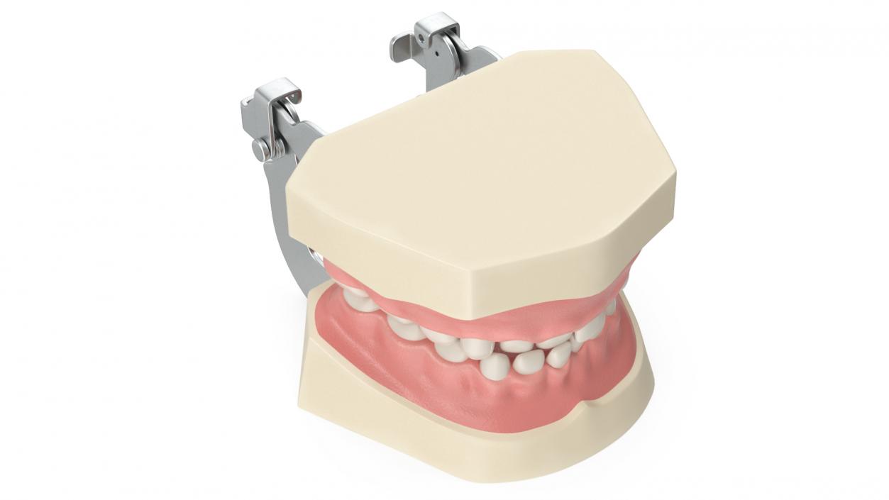 Dental Anatomy Model Simulation with Removable Crossbite Teeth 3D