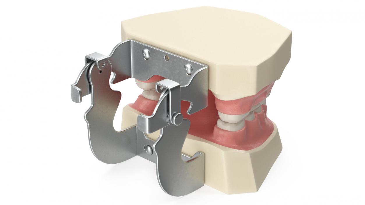 Dental Anatomy Model Simulation with Removable Crossbite Teeth 3D