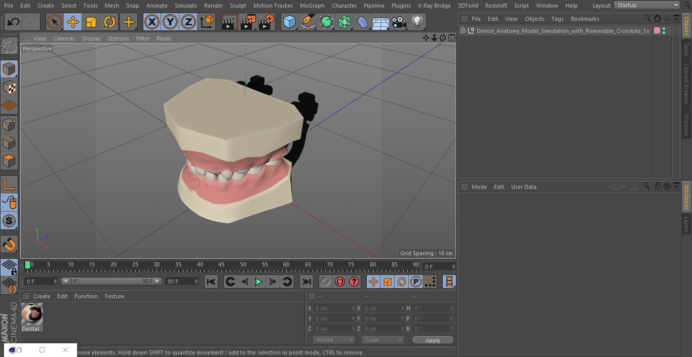 Dental Anatomy Model Simulation with Removable Crossbite Teeth 3D