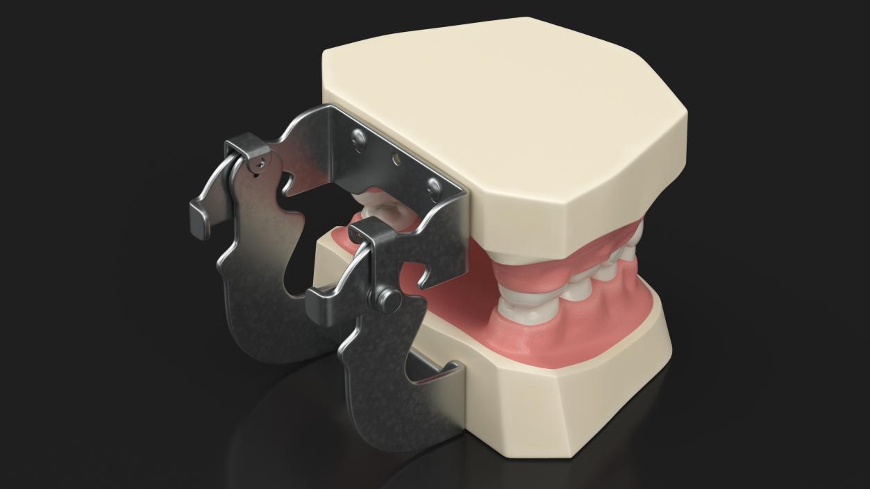 Dental Anatomy Model Simulation with Removable Crossbite Teeth 3D