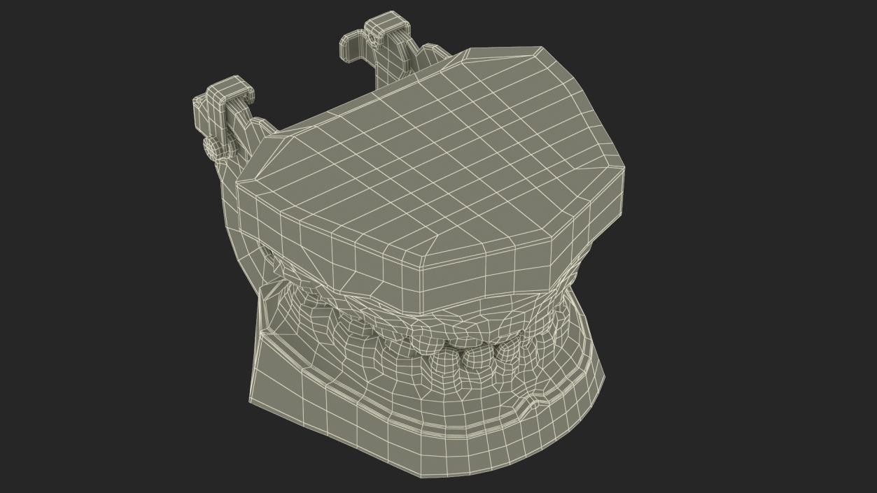 Dental Anatomy Model Simulation with Removable Crossbite Teeth 3D